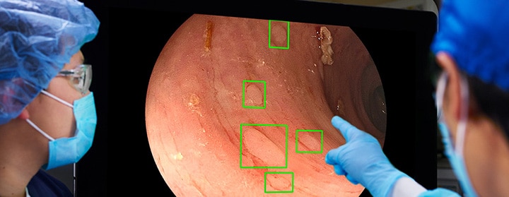 Two clinicians looking at a screening displaying endoscopy video with AI aided highlights of areas with adenomas.