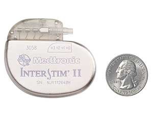 Medtronic InterStim II System next to a quarter to represent size.