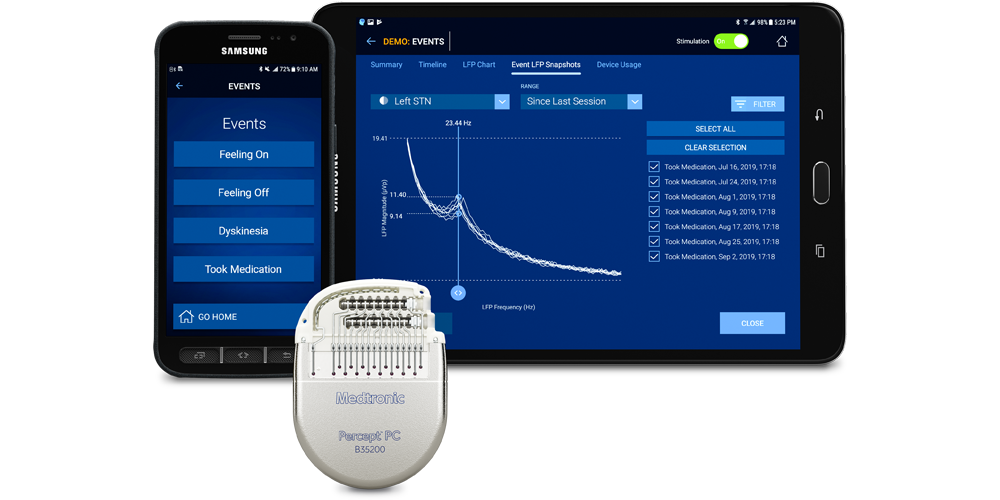Medtronic percept with programmers