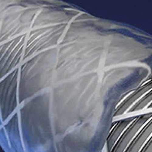 NITINOL