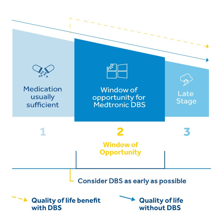 infographic showing the window of opportunity for DBS therapy in Parkinson's disease