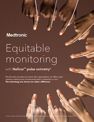 Overview of equitable patient monitoring solutions, emphasizing accuracy across all skin tones and demographics.