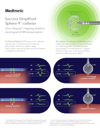 Overview of Close-Unipolar mapping technology with the Sphere-9 catheter for simplified electrogram interpretation.