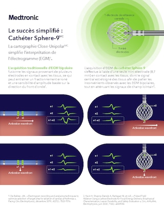 Presentation de la technologie de cartographie Close-Unipolar du catheter Sphere-9 pour simplifier l'interpretation des electrogrammes.