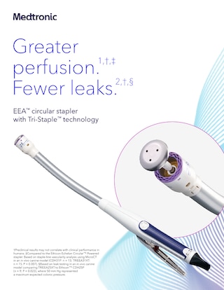 Overview of the EEA stapler with Tri‑Staple technology, highlighting improved perfusion, reduced leak rates, and consistent staple performance across tissue thicknesses.