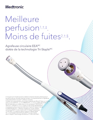 Apercu de l'agrafeuse EEA avec technologie Tri‑Staple mettant en avant une meilleure perfusion, une reduction des fuites et une performance constante des agrafes selon l'epaisseur des tissus.