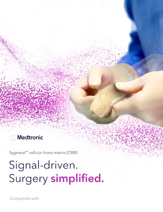 Learn about SygnaCel™ cellular bone matrix (CBM).