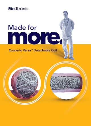 View the product brochure for the Concerto Versa™ detachable coil.