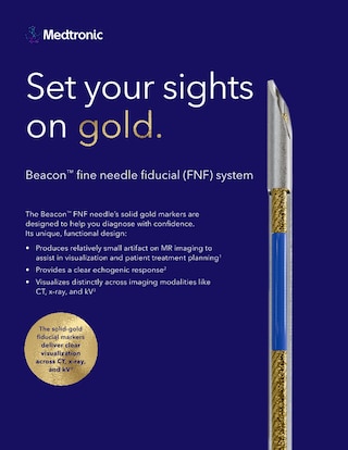 View the Beacon™ FNF system brochure.