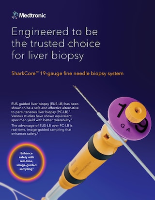 Information sheet for the SharkCore™ FNB 19 gauge liver biopsy 