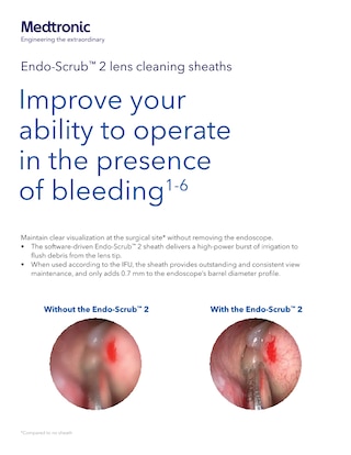 Endo-Scrub™ 2 lens cleaning sheaths Brochure