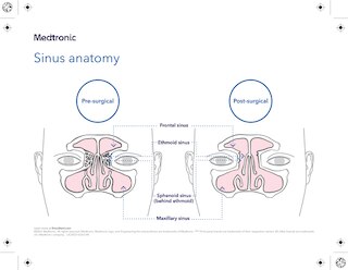 Download the sinus anatomy pad.