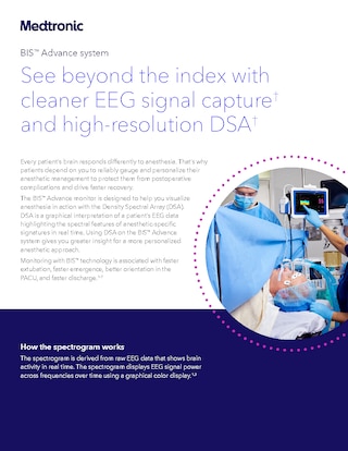 Brochure on Density Spectral Array for BIS Advance.