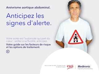 Guide interactif destiné aux patients sur les facteurs de risque, les symptômes et les options de traitement (EVAR ou chirurgie ouverte) de l’anévrisme de l’aorte abdominale (AAA).