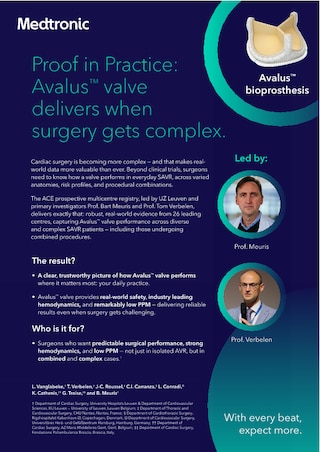 ACE data brochure on Avalus valve.