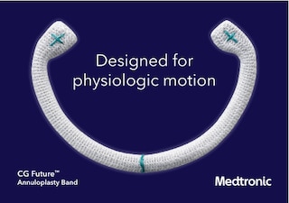 CG Future™ Annuloplasty Band Product Brochure