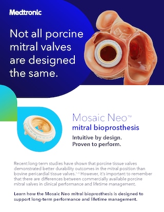 Dowload the Mosaic Neo™ mitral bioprosthesis documnent ad.