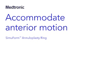 SimuForm™ Annuloplasty Ring European Product Brochure