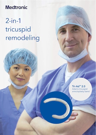 Tri-Ad™ 2.0 Adams Tricuspid Annuloplasty Band European Product Brochure