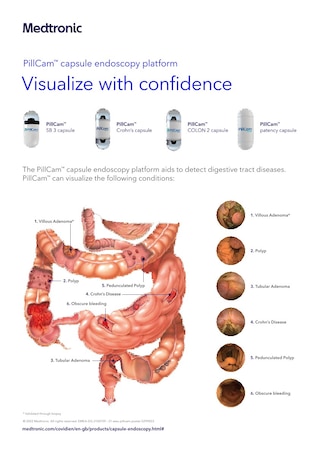 Poster: Pillcam 