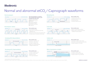 Capnography waveform poster displaying labeled waveform examples and reference information for clinical environments.