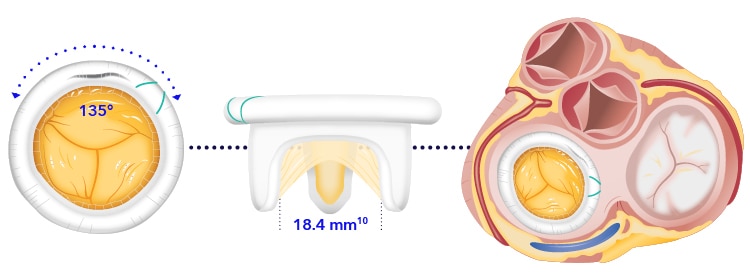 Mosaic™ Mitral Bioprosthesis | Medtronic