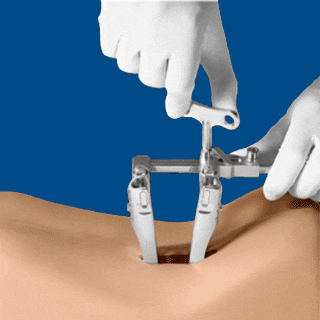 animated gif of spinal procedure