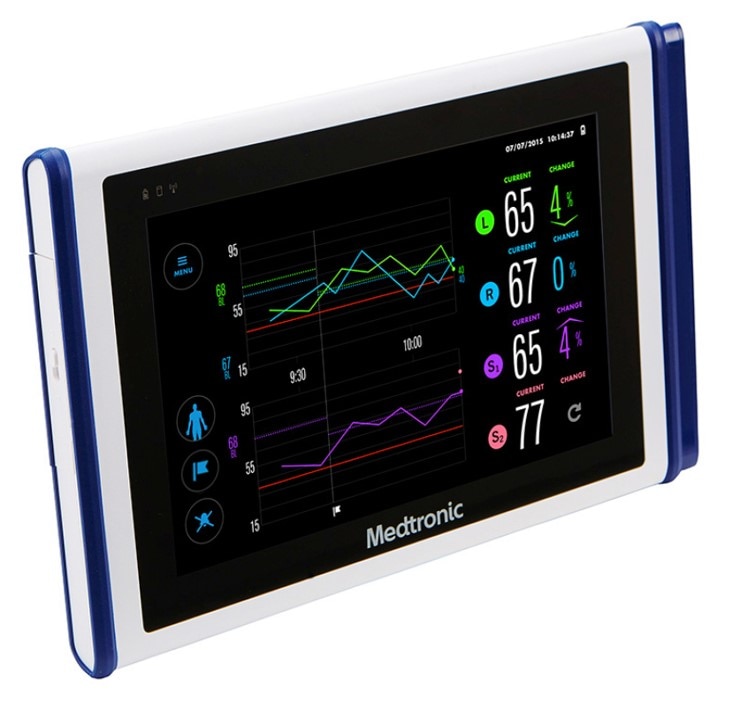 Invos 7100 system tablet