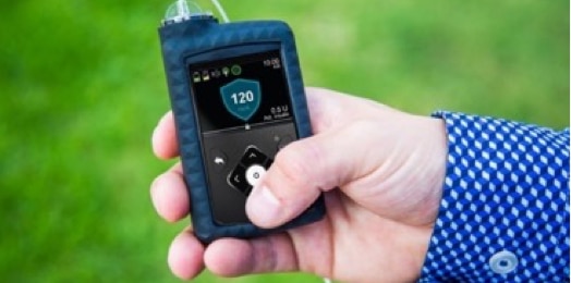A photo of a hand holding a mini-med insulin pump